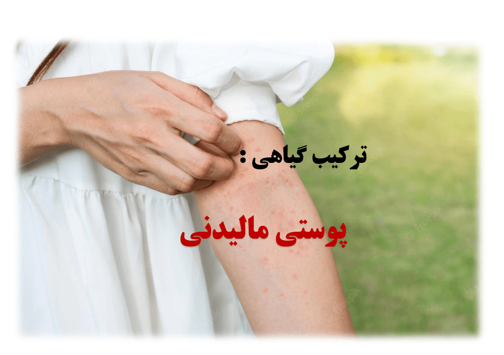 پوستی مالیدنی